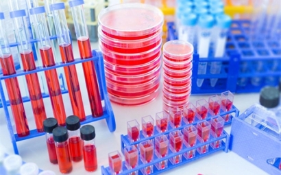 進(jìn)口細(xì)胞清關(guān)需要哪些資料，了解一下！